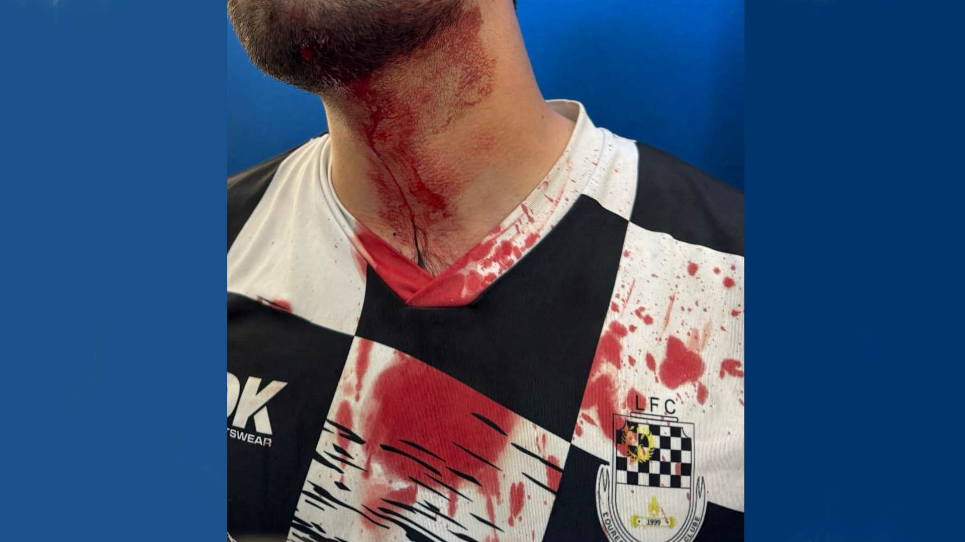 Agredido2 - Rádio Pax 2026